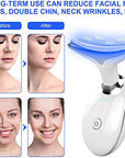 Neck Face Beauty Device EMS