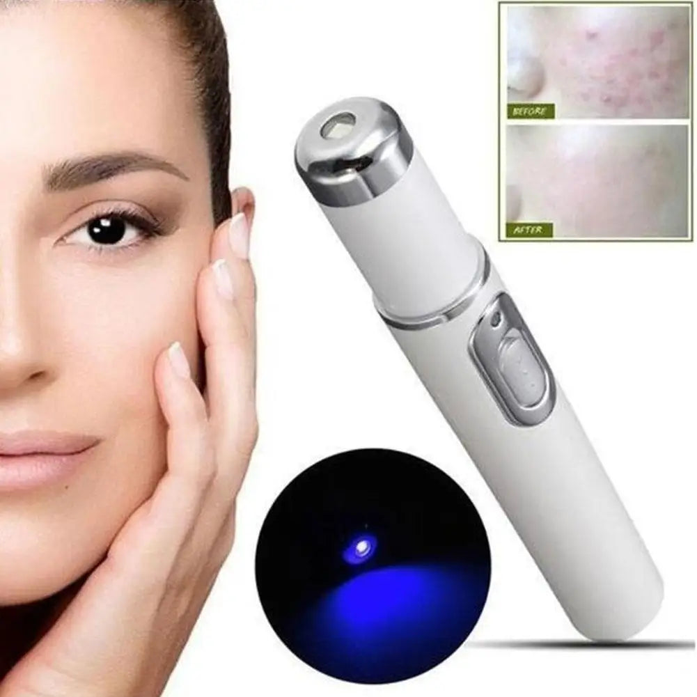 Blue Light Therapy Acne Laser Pen