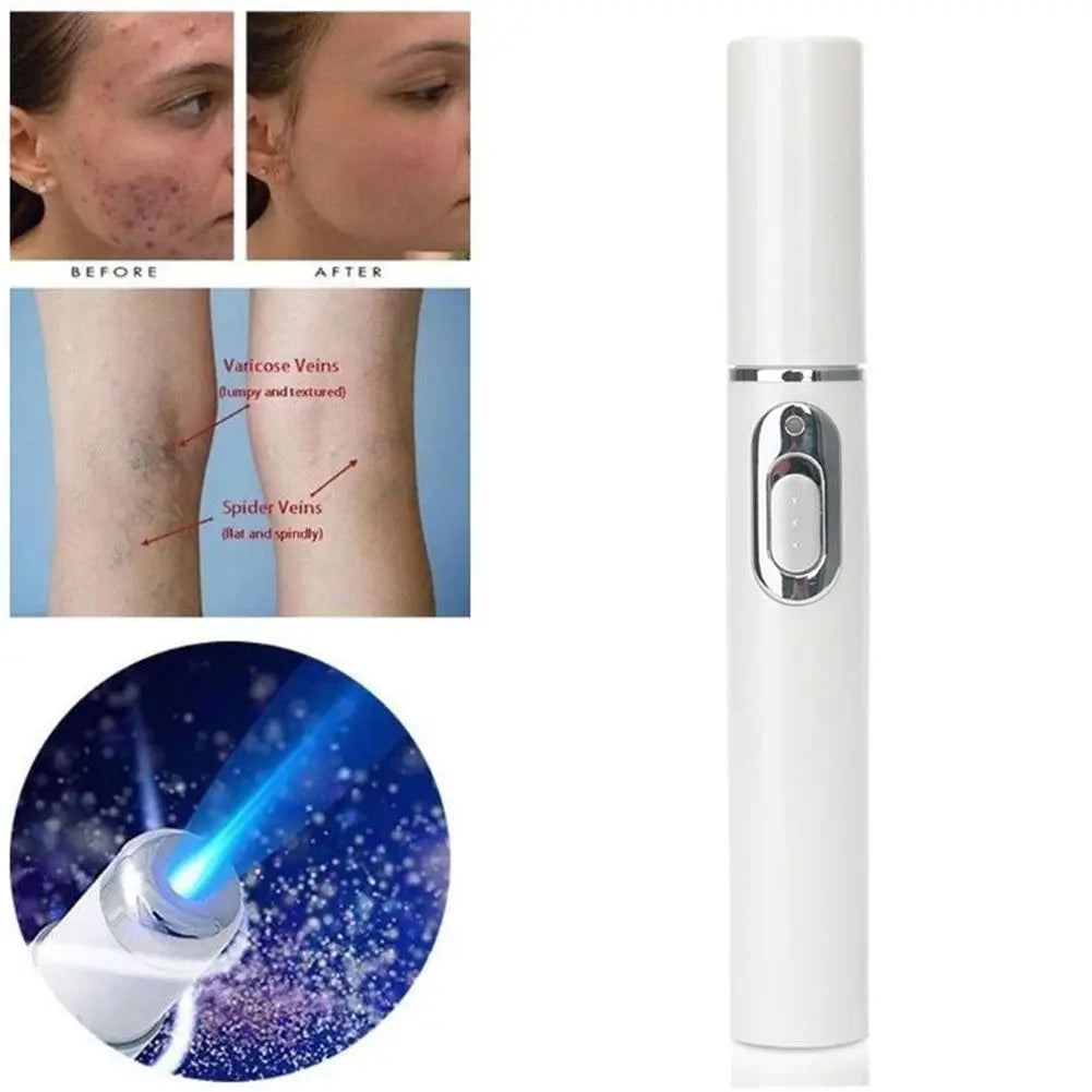 Blue Light Therapy Acne Laser Pen